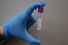 Catlab, el primer laboratori autoritzat per l'Estat en fer PCR amb l'acreditació de l'ENAC
