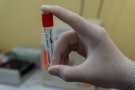 Argimon reclama a l'Estat ampliar la franja d'edat de la vacuna d'Astra Zeneca