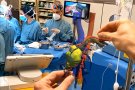 Can Ruti i la UAB implanten la realitat augmentada a quiròfan