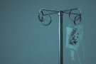L'Hospital de Terrassa utilitza un dispositiu de prevenció de l'alopècia en malaltes de càncer de mama