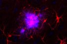 Un estudi de la UAB analitza com canvia l'expressió genètica al cervell amb l'Alzheimer