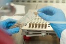 Investigadors de la UAB descobreixen un tractament que redueix la inflamació de l'esclerosi múltiple en ratolins