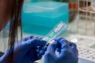 Investigadors de la UAB identifiquen les neurones que provoquen el mareig