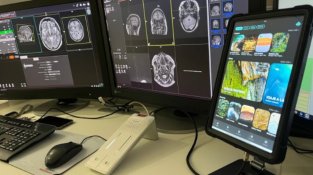 L’Hospital General de Granollers introdueix una tecnologia de so immersiu per reduir l’estrès en ressonàncies magnètiques