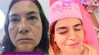 Diana Bust Centro Estético