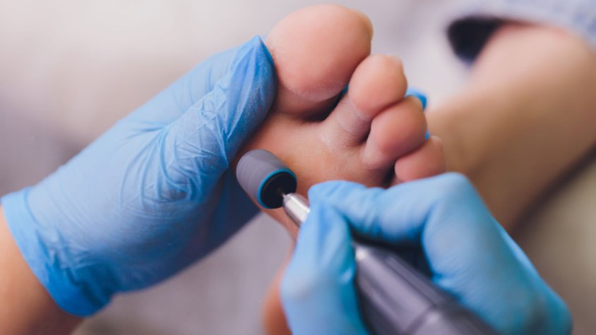 Detinguda una falsa podòloga a Terrassa