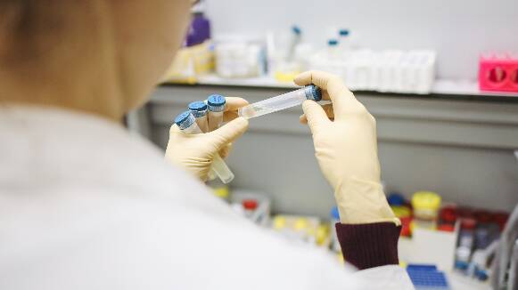 AMPLIACIÓ:Catalunya registra 822 nous casos confirmats per PCR o epidemiològicament i no es reporta cap mort