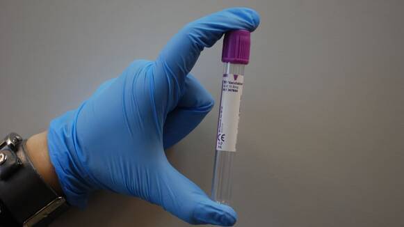 Catlab, el primer laboratori autoritzat per l'Estat en fer PCR amb l'acreditació de l'ENAC