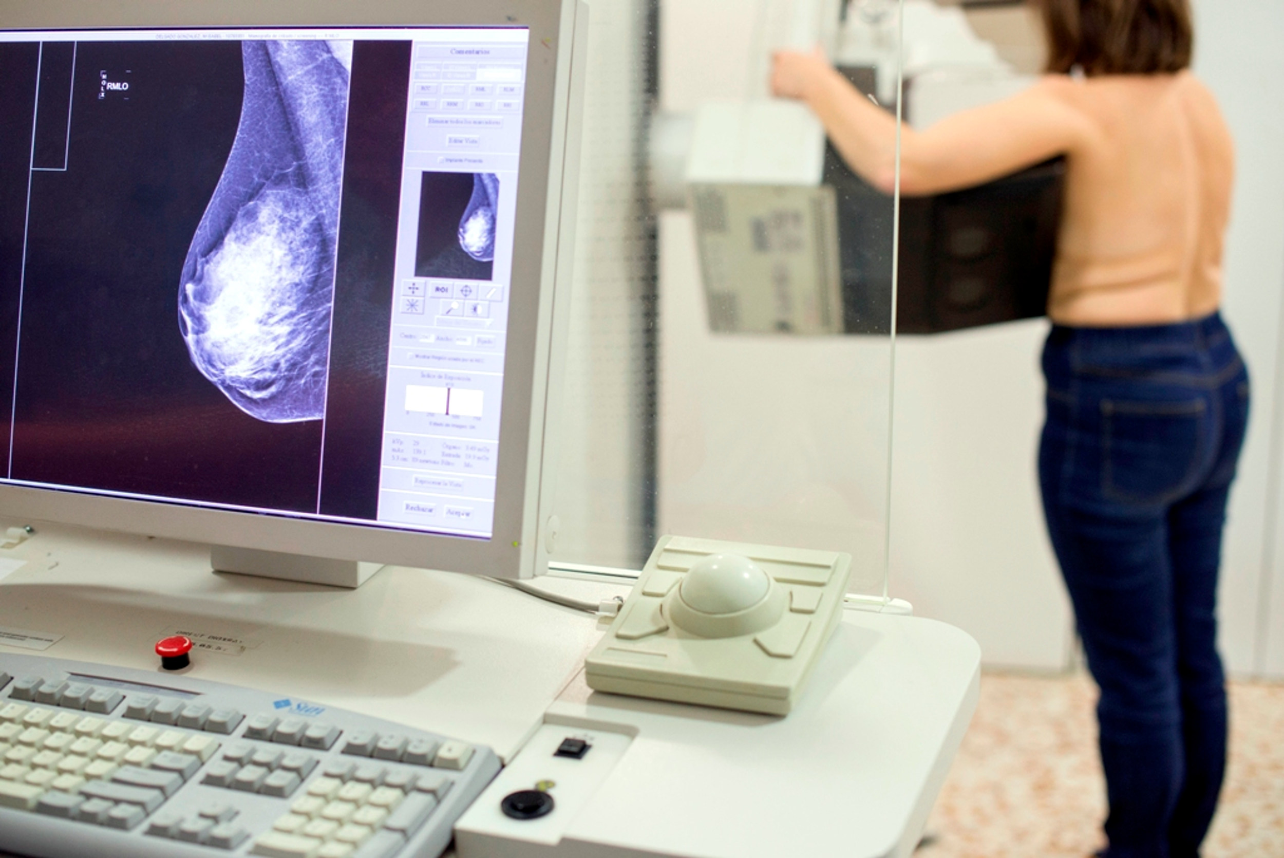 Cada any es diagnostiquen 4.600 nous casos de càncer de mama a Catalunya